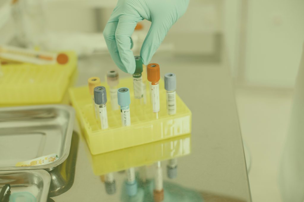 Gloved hand placing a labeled sample tube into a rack in a laboratory
